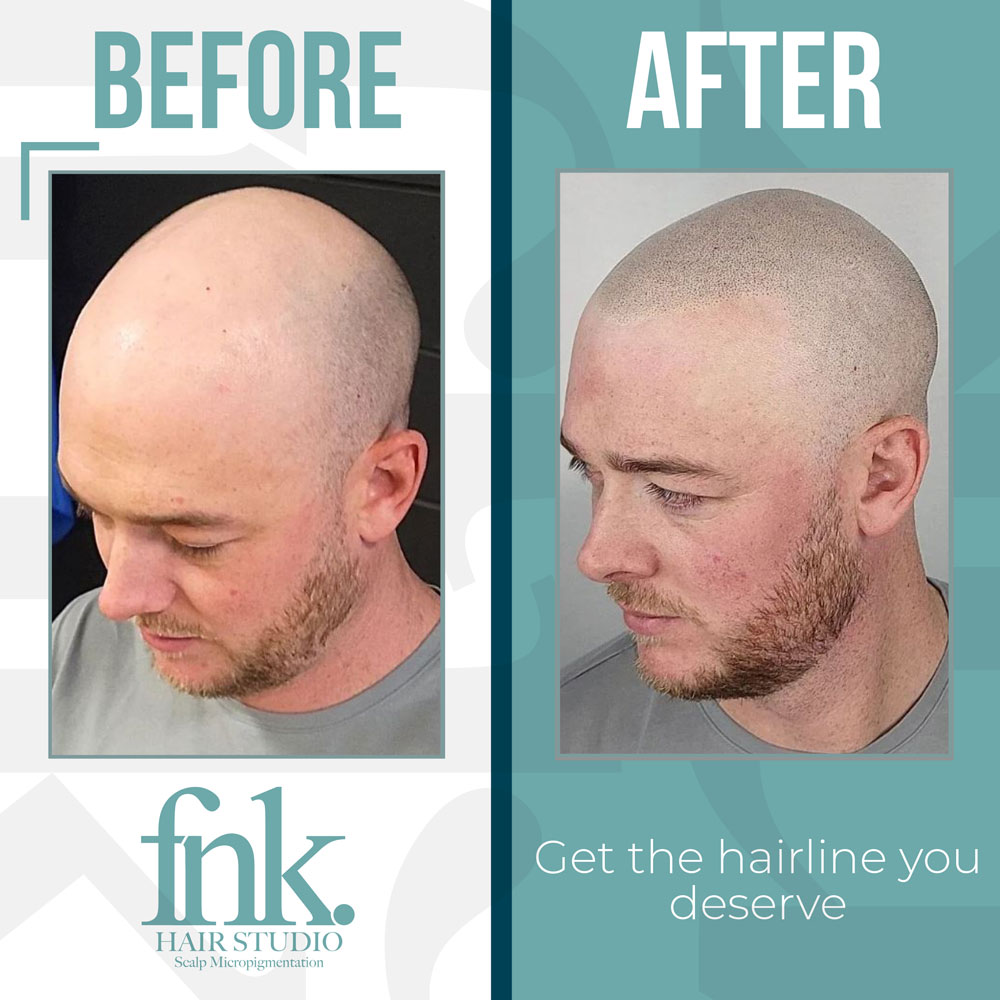 Hair Tattoo Before and After FNK Hair Studio