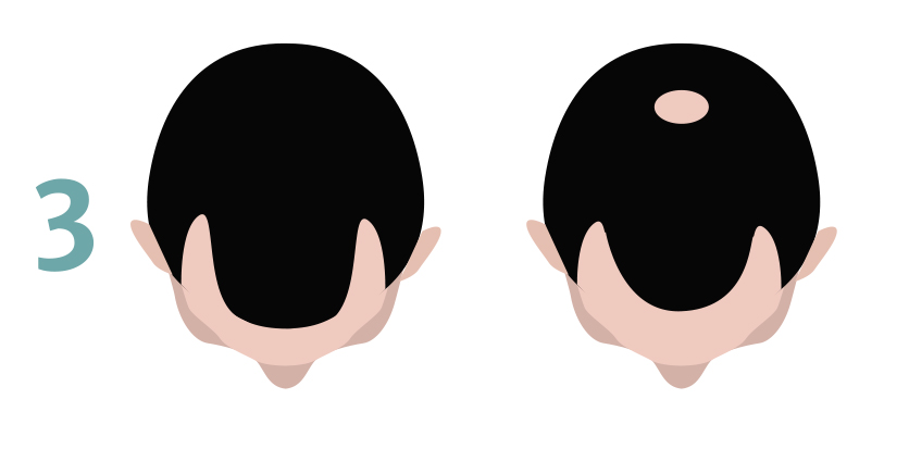 hair tattoo cost uk - stage 3