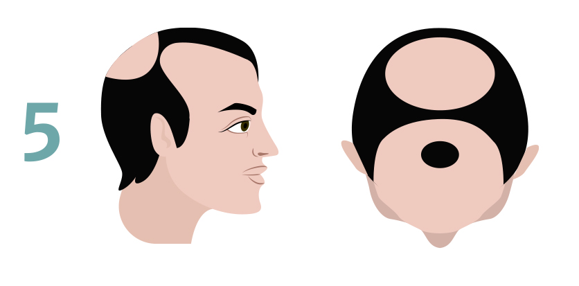 hair tattoo cost
