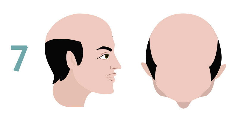 hair tattoo on head