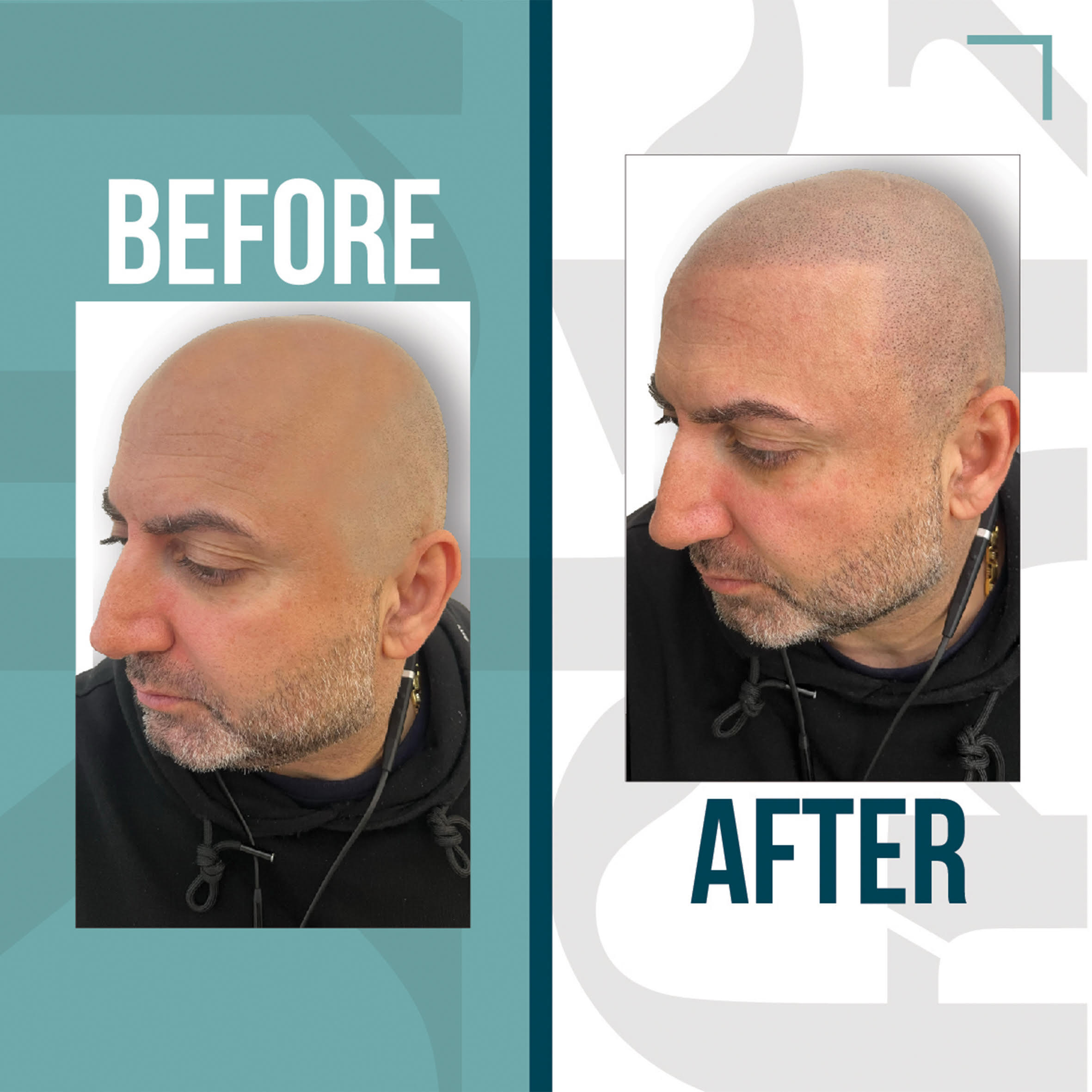SMP Hair Nottingham